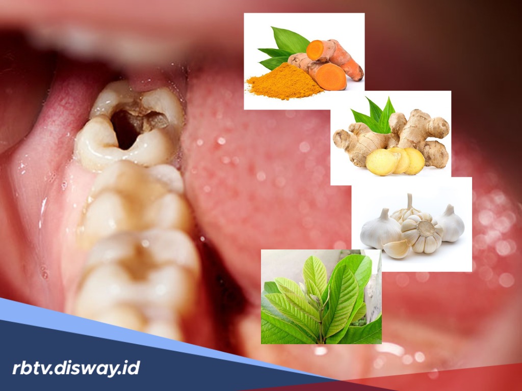Lebih Manjur! Ini 4 Tanaman Obat untuk Atasi Sakit Gigi Berlubang, Sudah Coba? 