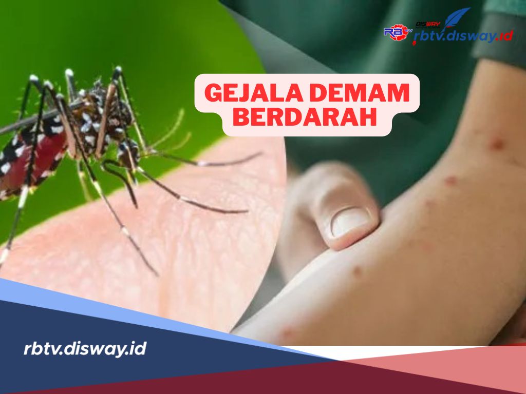 Penyakit Mematikan! Kenali Ini Gejala Demam Berdarah Dengue (DBD)