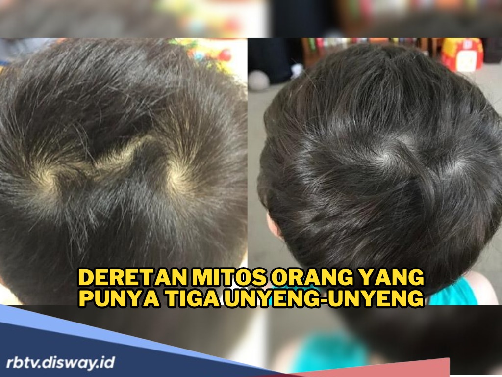 Mitos Unik Pemilik3 Unyeng-unyeng di Kepala, Konon Katanya Punya Naluri Tajam