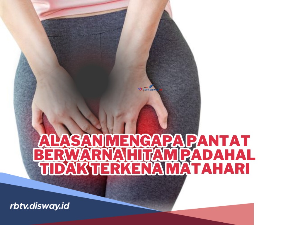 Mengapa Pantat Berwarna Hitam Padahal Tidak Terkena Matahari? Begini Caranya agar Kulitnya Cerah