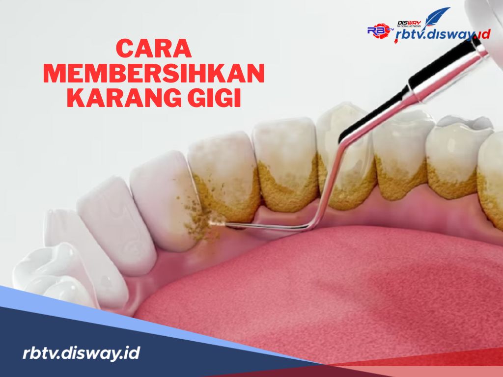 7 Cara Membersihkan Karang Gigi Membandel, Dijamin Ampuh dan Aman