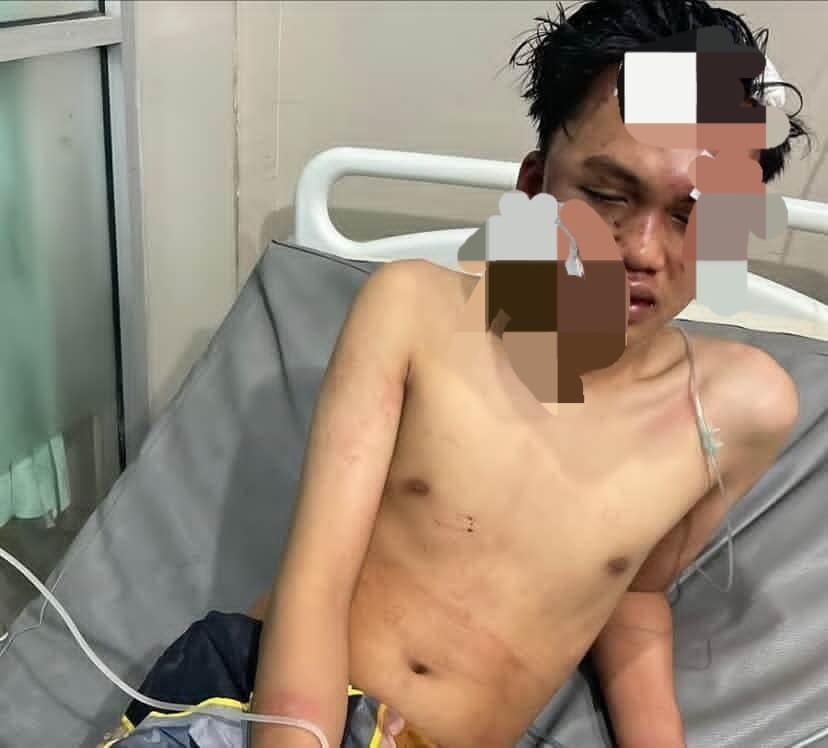 Peristiwa Berdarah di Cafe GMC Pantai Panjang, Remaja Asal Sumsel Babak Belur dan Harus Jalani Operasi