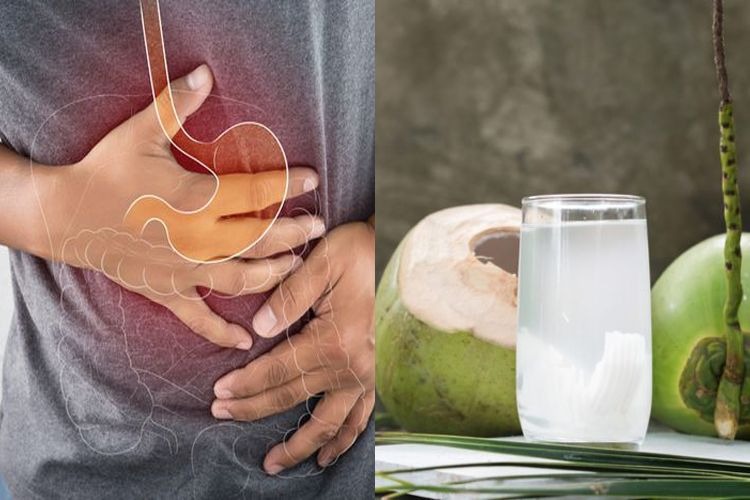 Memang Ada Manfaat Air Kelapa, Tapi jika Diminum Berlebihan Penderita Asam Lambung, Ini Akibatnya 