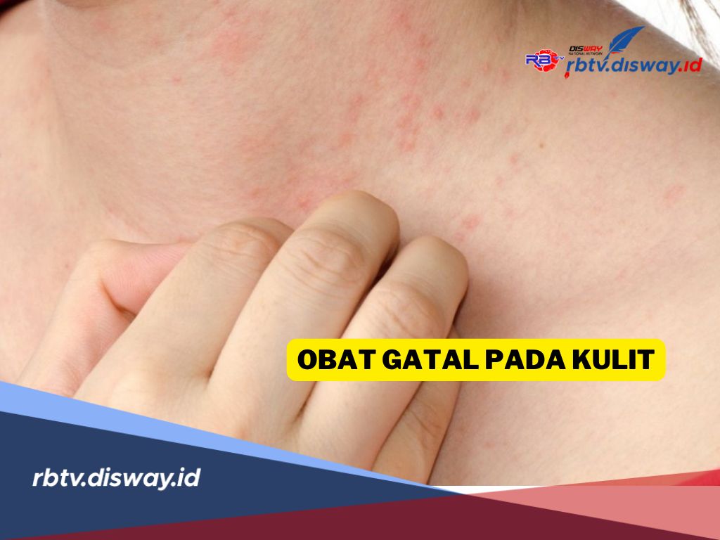Ini Rekomendasi Obat Gatal Pada Kulit yang Paling Ampuh dan Cepat Sembuh, Sudah Coba? 