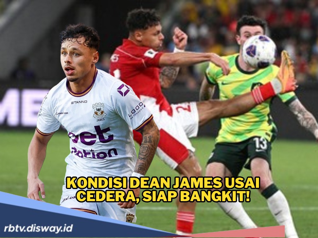 Kondisi Dean James Pasca Cedera Hamstring, Apa Bisa Perkuat Timnas Indonesia di Kualifikasi Piala Dunia 2026