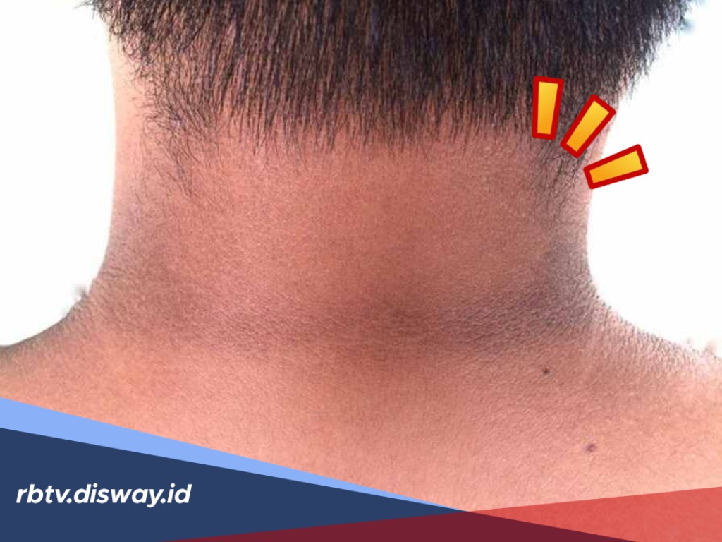 4 Cara Alami Cerahkan Kulit Leher yang Gelap Supaya Terang