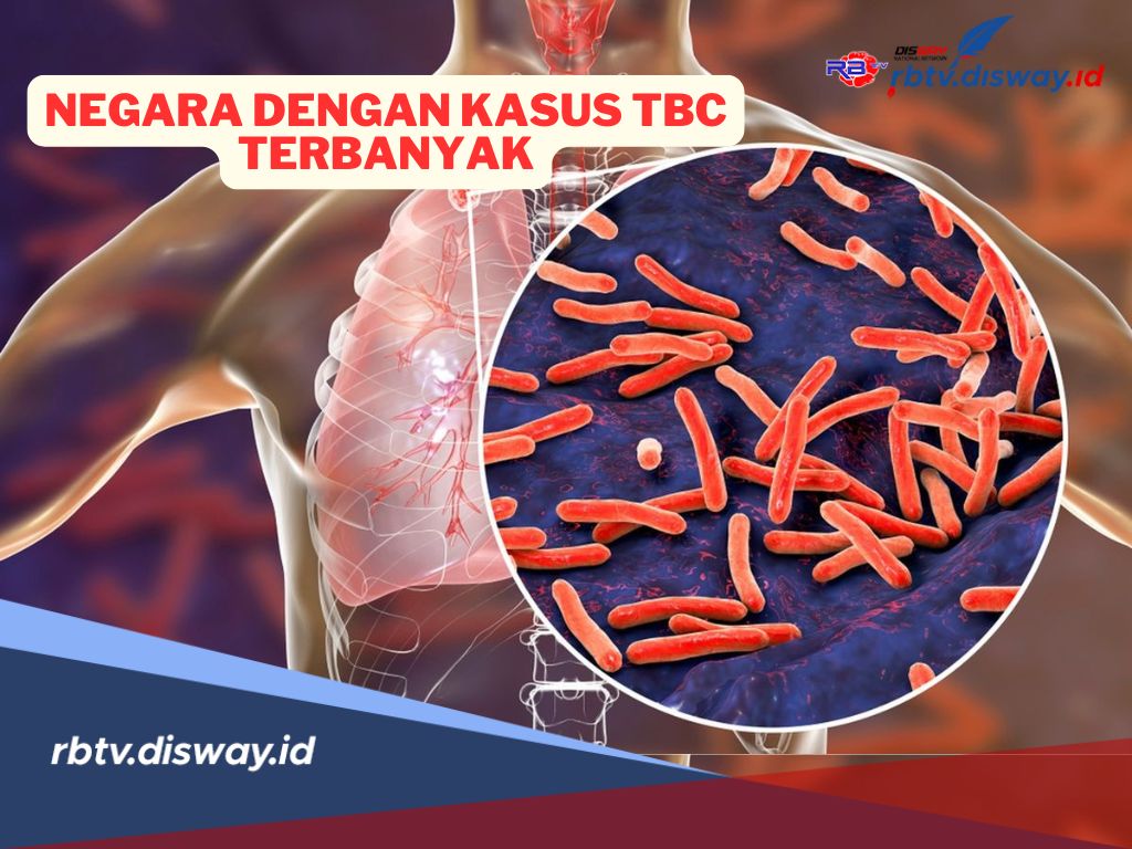 5 Negara dengan Kasus TBC Terbanyak di Dunia Berdasarkan Data WHO, Indonesia Urutan?