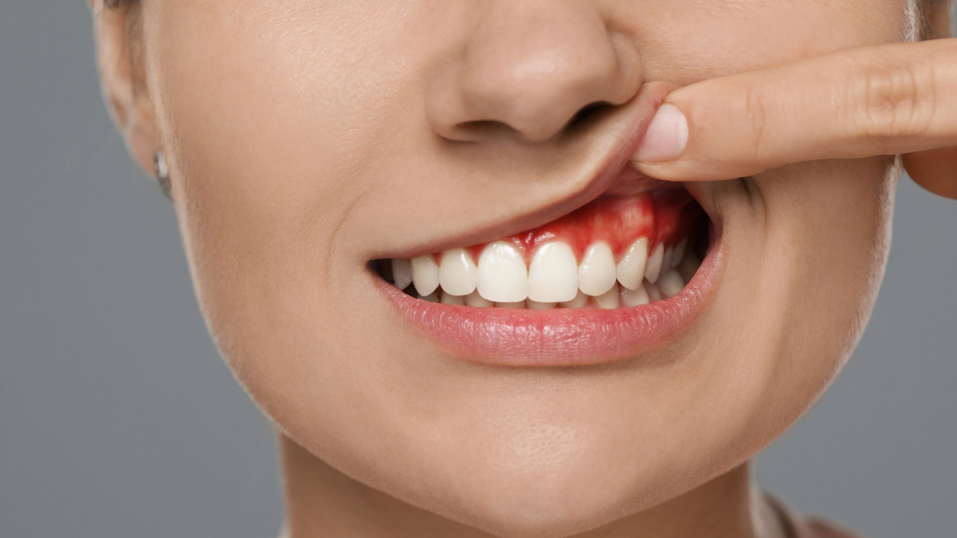 Buka Mulut saja Sulit Karena Gusi Bengkak, Ini 12 Tanaman Obat Keluarga Atasi Gusi Bengkak