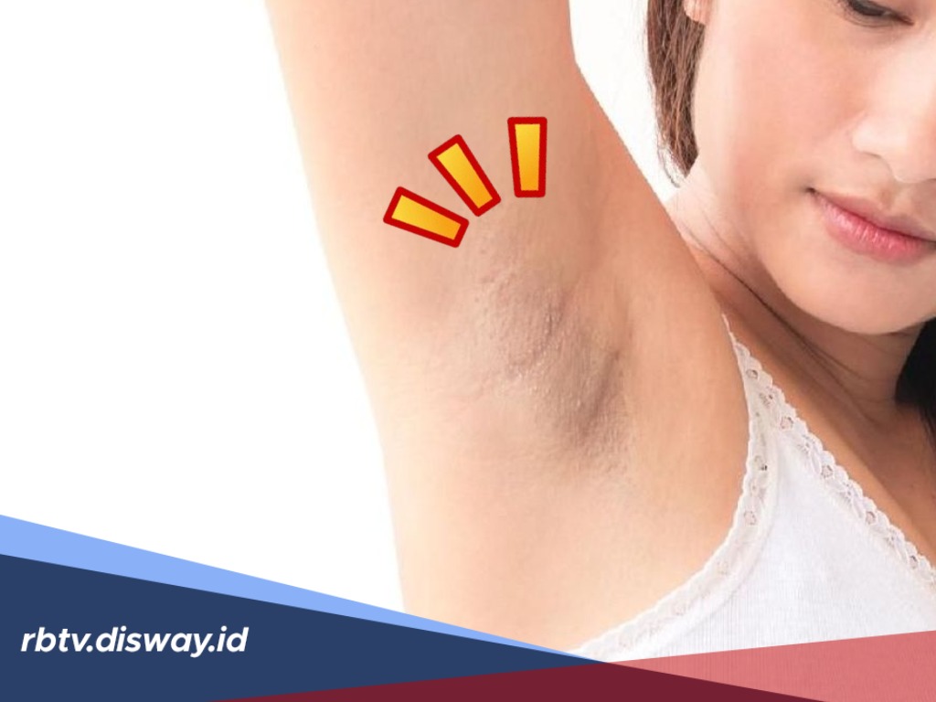 4 Cara Alami Cerahkan Kulit Ketiak yang Hitam Tanpa Perwatan Dokter