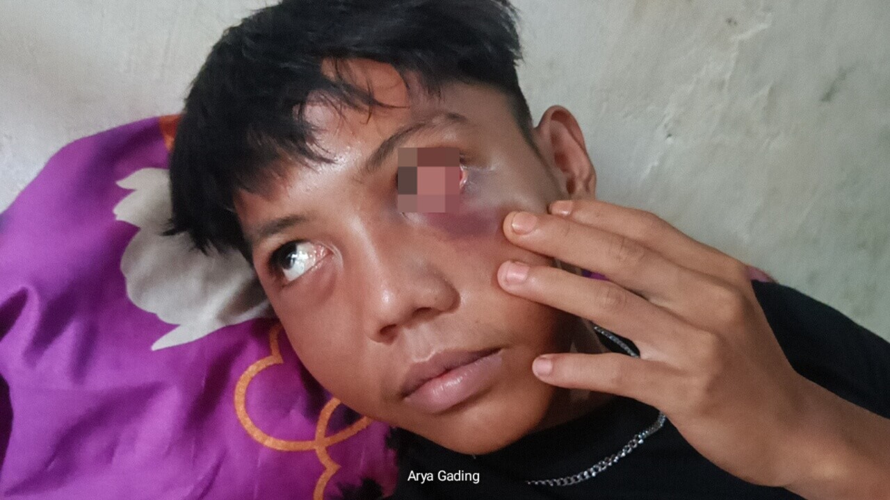 3 Pemuda Sembayat Seluma Babak Belur Usai Nonton Orgen Tunggal di Acara Pesta Pernikahan