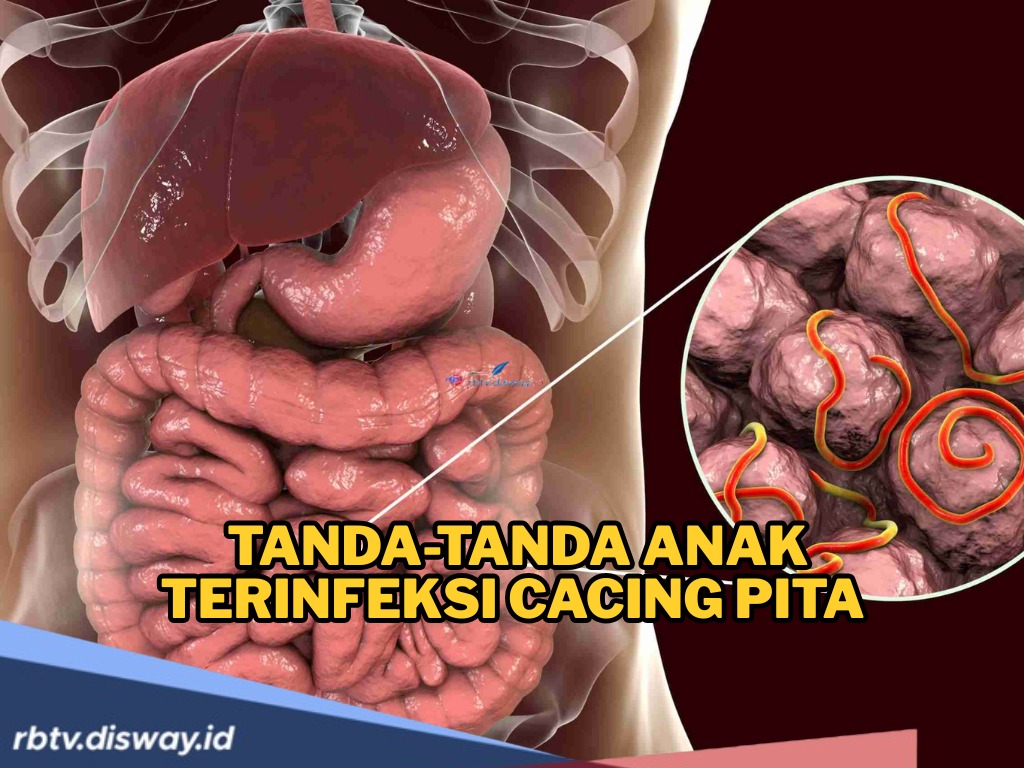 Jangan Diabaikan, Kenali Tanda-tanda Anak Terinfeksi Cacing Pita, Bahaya Jika Tidak Ditangani