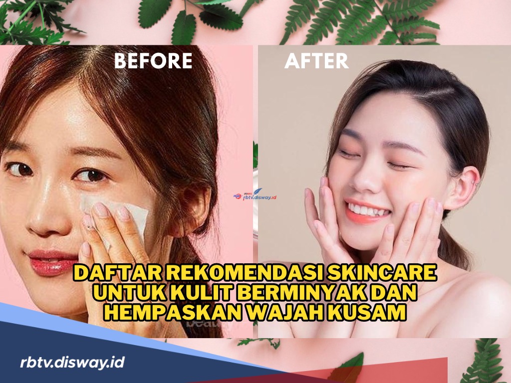 Ini Daftar Rekomendasi Skincare untuk Kulit Berminyak dan Hempaskan Wajah Kusam, Harganya Affordable