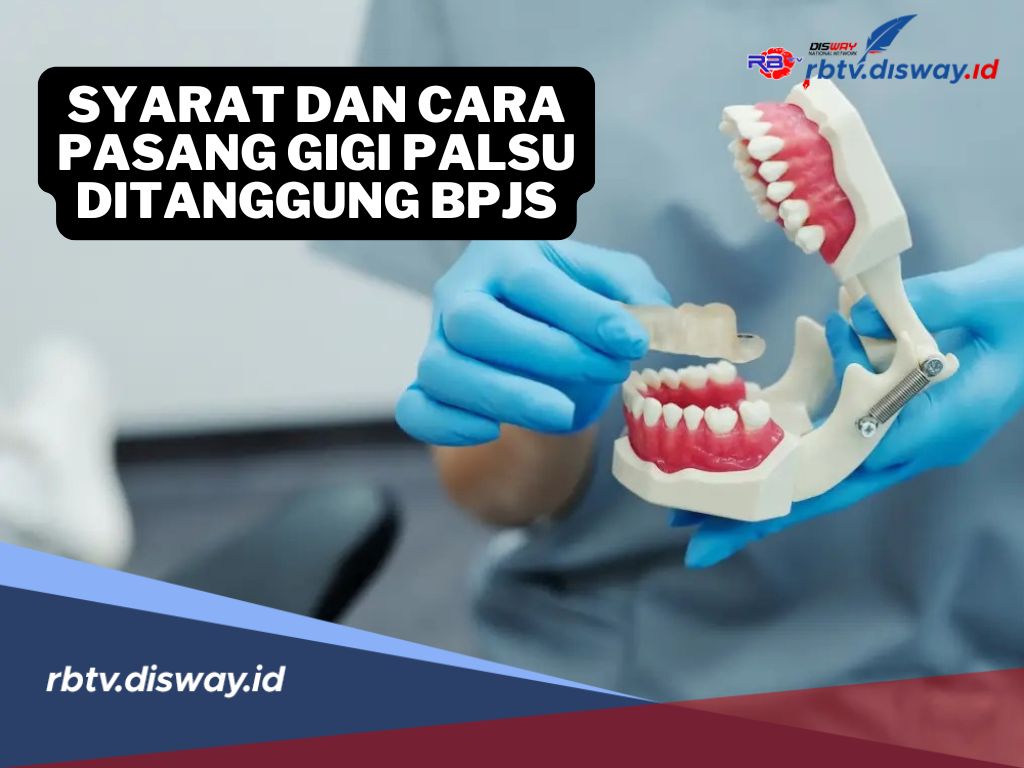 Pasang Gigi Palsu Ditanggung BPJS! Yuk, Simak Ini Syarat dan Cara Mendapatkannya!