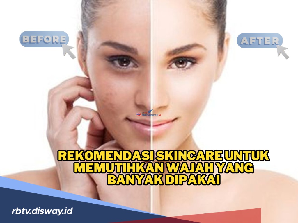 Stop Insecure! Ini Rekomendasi Skincare untuk Memutihkan Wajah, Cocok untuk Remaja