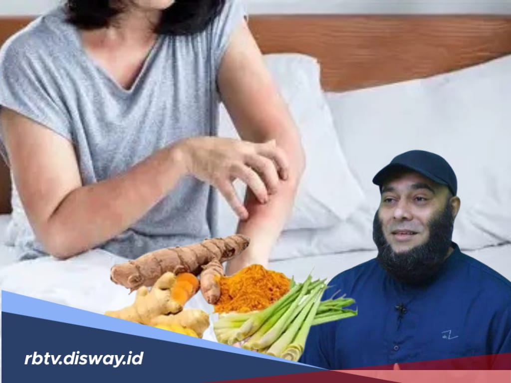 Kulit Gatal Langsung Sembuh Tanpa ke Medis, Kata Dokter Zaidul Akbar Pakai 3 Ramuan Ini