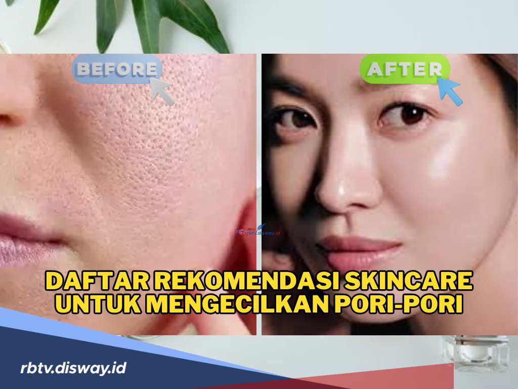 Hai Ciwi-ciwi, Ini Daftar Rekomendasi Skincare untuk Mengecilkan Pori-pori, Wajah Auto Mulus