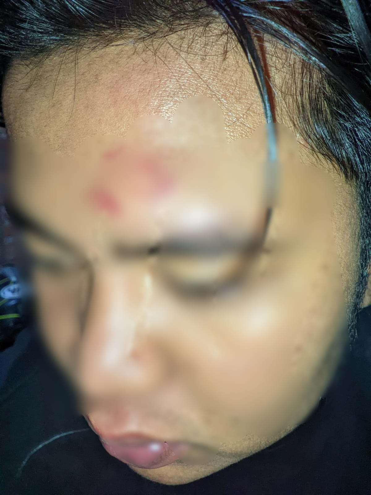 Waspada Aksi Berandalan Jalanan di Kota Bengkulu Meneror, 2 Pemuda Jadi Korban 