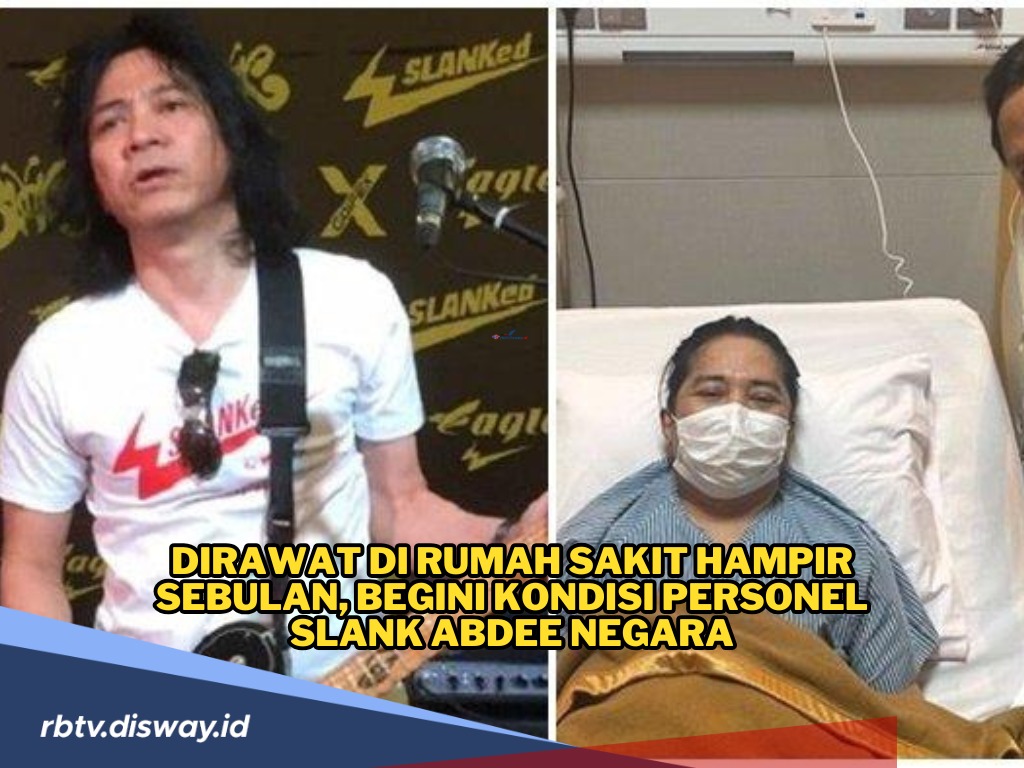 Sudah Hampir Sebulan Dirawat di Rumah Sakit, Begini Kondisi Abdee Negara Gitaris Slank