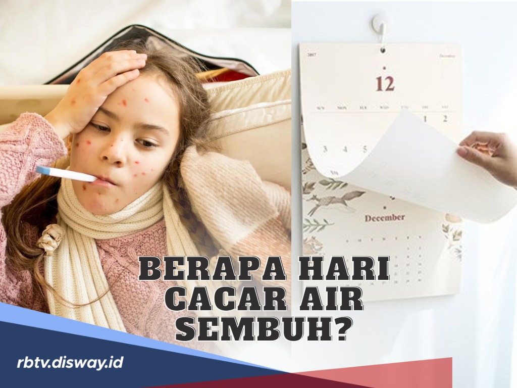 Pastinya Membuat Tidak Nyaman, Lantas Berapa Hari Cacar Air Bisa Sembuh?