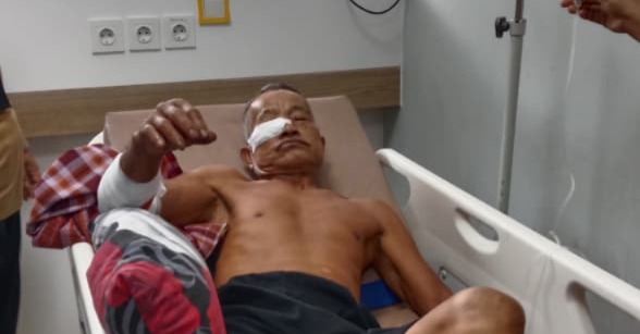 Lansia di Taba Penanjung Bengkulu Tengah Diserang Beruang 