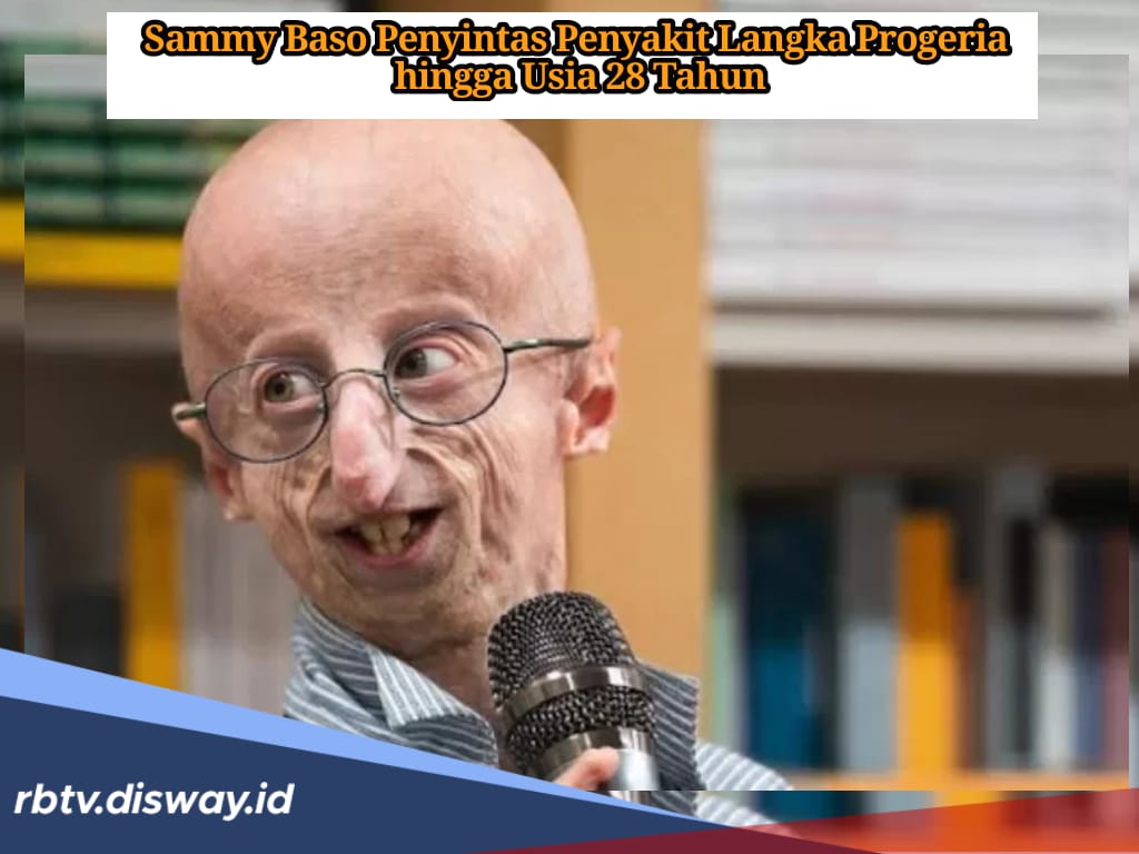 Sammy Basso, Pengidap Penyakit Progeria Terlama Meninggal Dunia