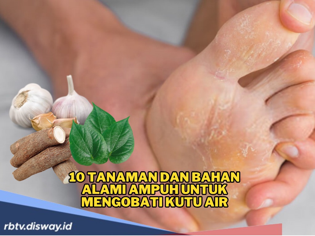 Sulit Ngapa-apain Karena Kutu Air, Tenang Ini 6 Tanaman Obat Keluarga untuk Atasi Kutu Air