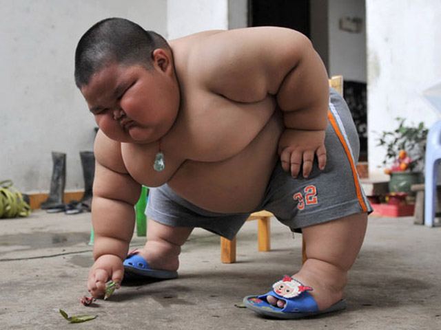 6 Cara Diet untuk Anak-anak dan Pilihan Menu Makanan Paling Direkomendasikan