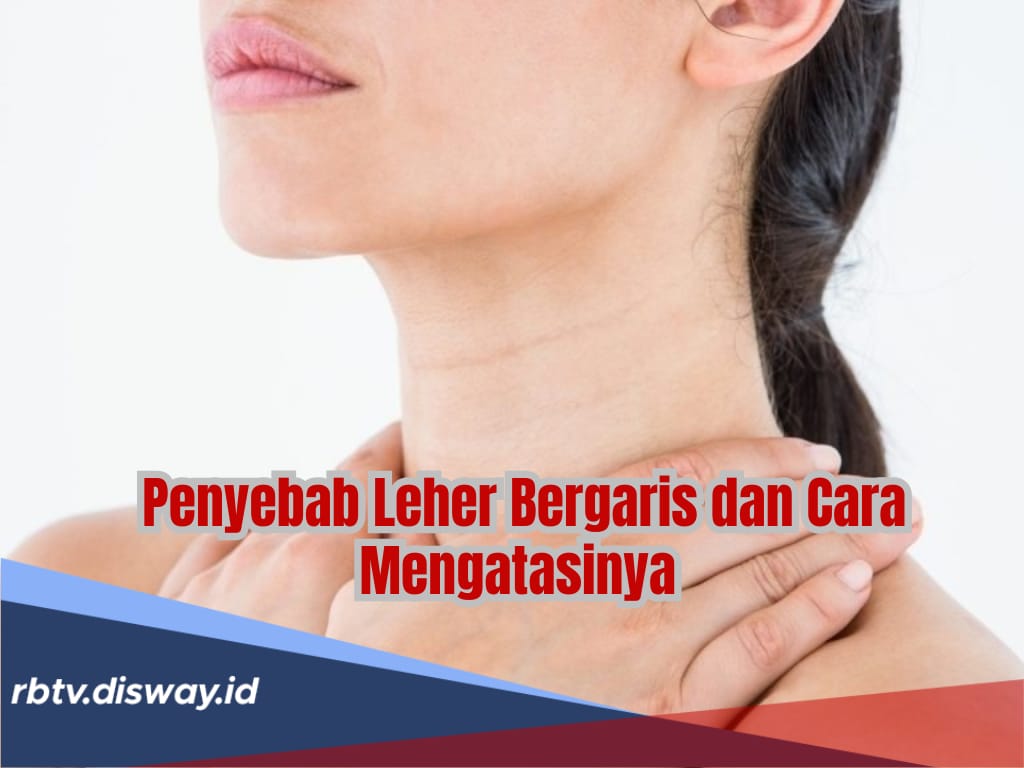Alami Leher Bergaris? Tak Perlu Risau Kenali 6 Penyebab, Beserta Cara Alami Mengatasinya