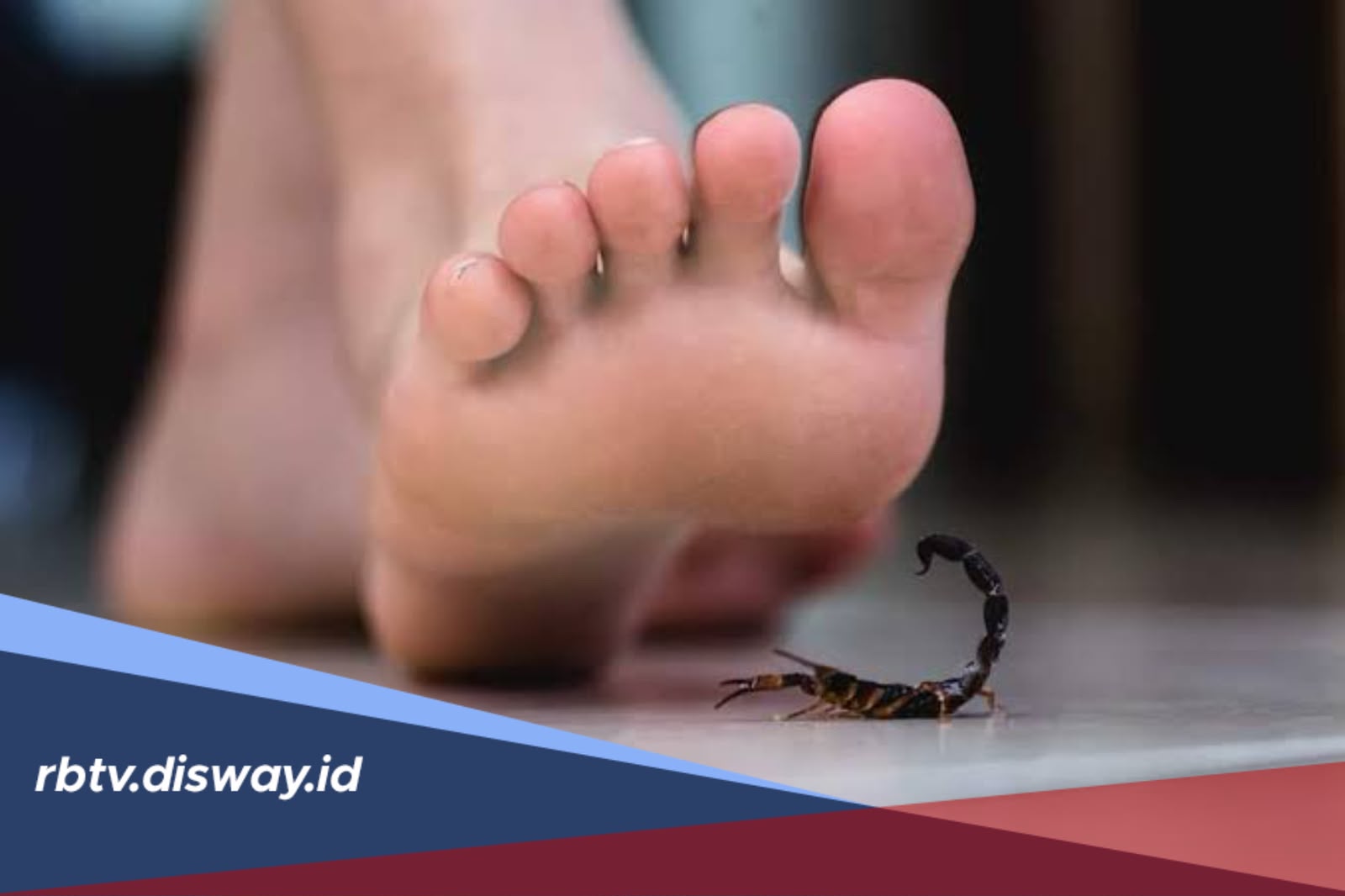 5 Langkah Pertolongan Pertama Saat Disengat Kalajengking