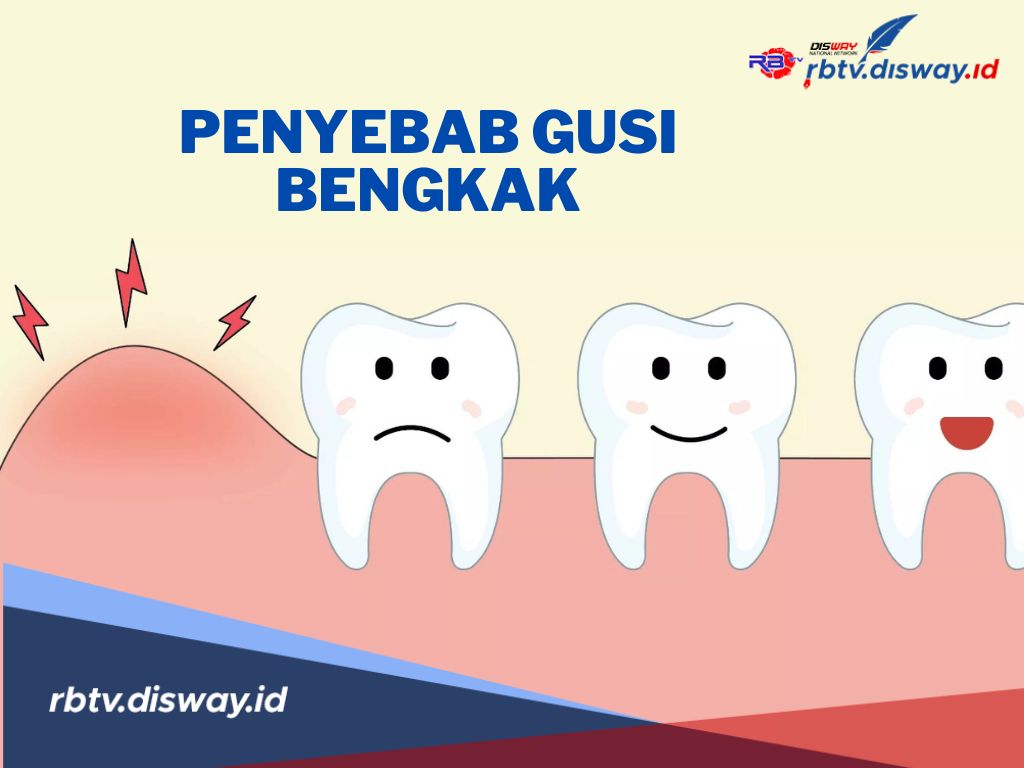 Apa Penyebab Gusi Bengkak? Menurut Ustadz Dhanu, Coba Perhatikan Hal Ini