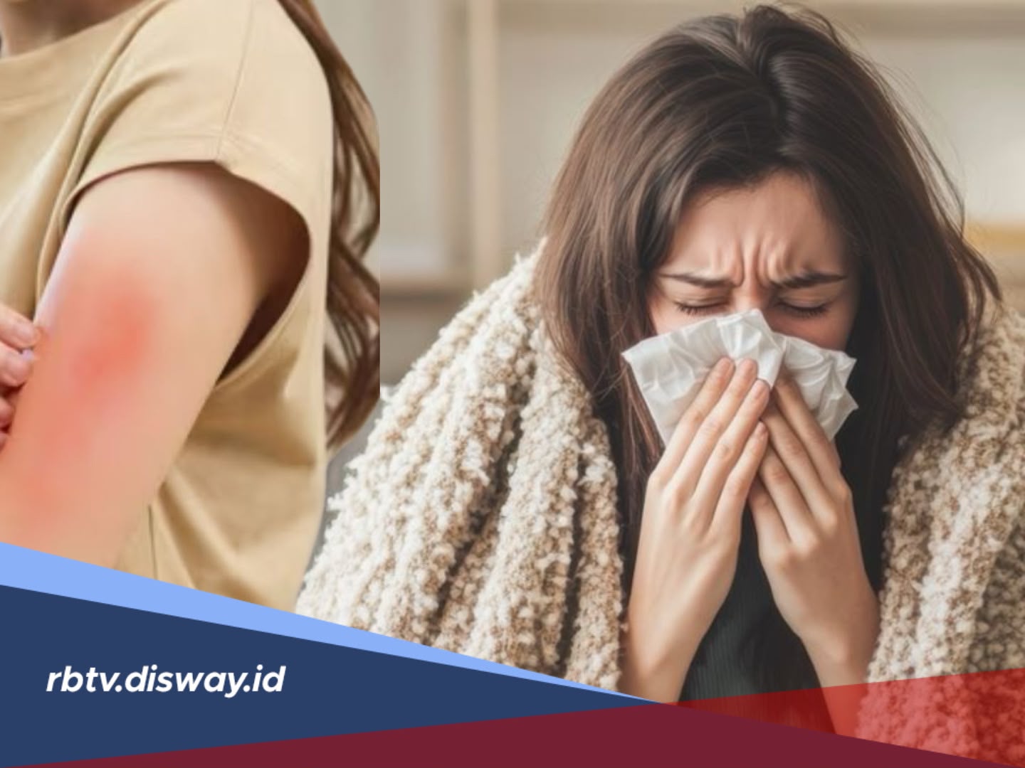 Alergi Gatal dan Bersin? Coba Redakan dengan Bahan Alami Ini