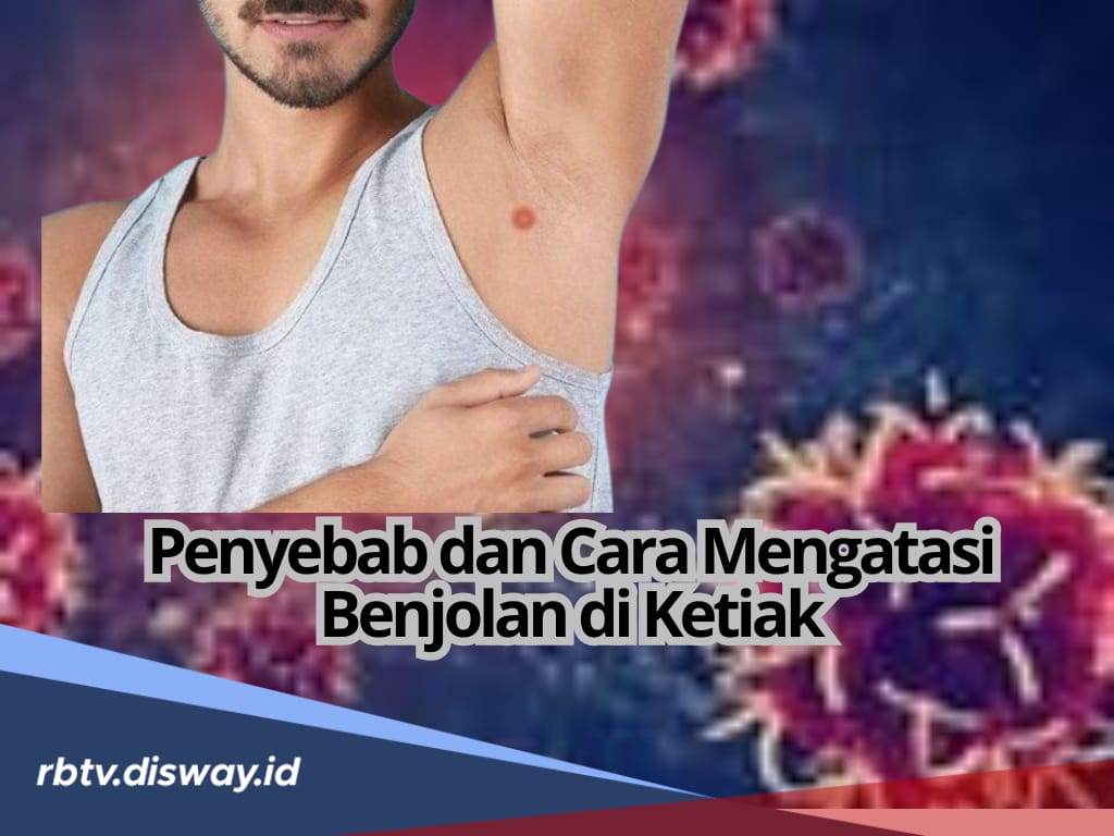 Punya Benjolan di Ketiak yang Bikin Khawatir, Ini 6 Penyebab dan Cara Mengatasinya