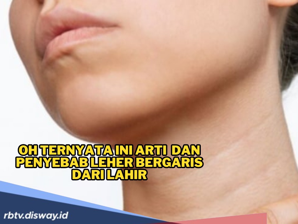 Punya Garis Leher Sejak Lahir dan Sering Diledek? Yuk, Kenali Penyebab Sebenarnya dan 