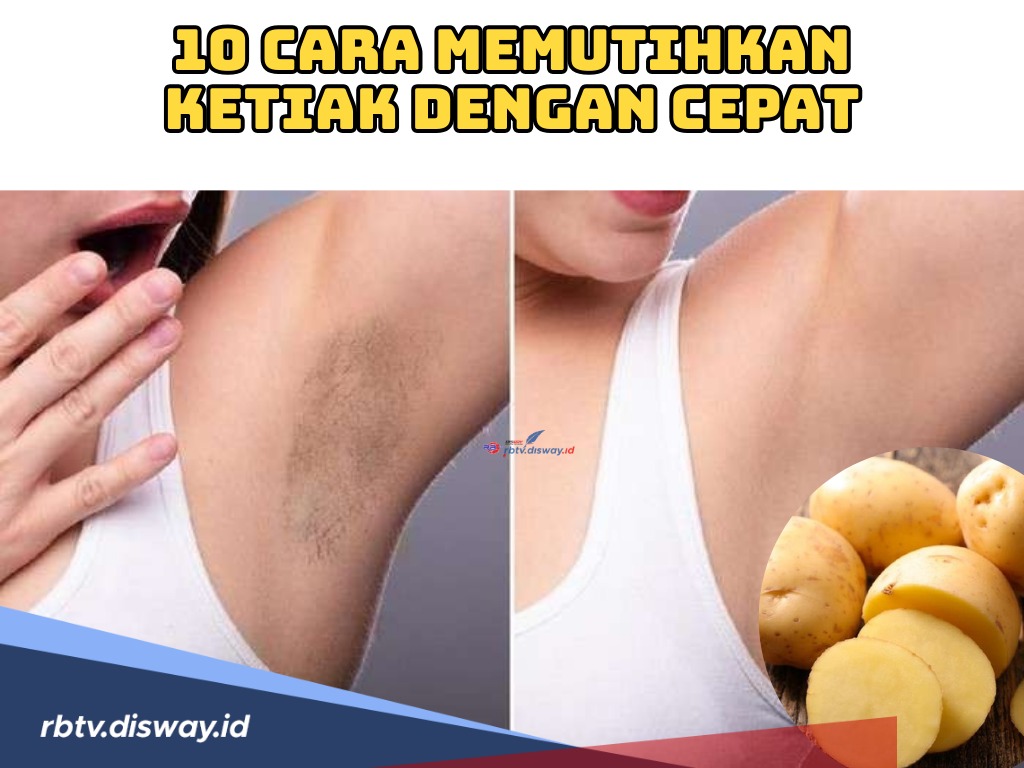 Diklaim Efektif! Ini 10 Cara Memutihkan Ketiak dengan Cepat, Salah Satunya dengan Kentang