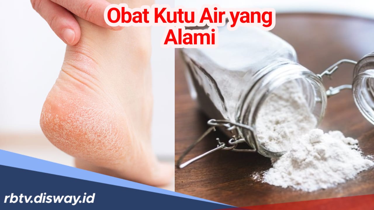 7 Obat Alami untuk Basmi Kutu Air, Bisa Ditemukan di Rumah