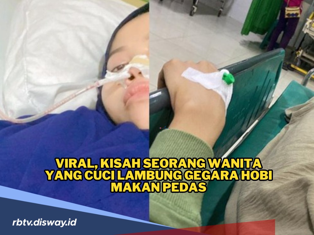 Viral, Kisah Seorang Wanita yang Cuci Lambung Gegara Hobi Makan Pedas, Ini Dampaknya! 