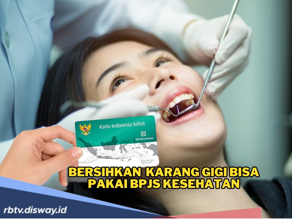 Banyak yang Belum Tahu, Ternyata Bersihkan Karang Gigi Bisa Pakai BPJS Kesehatan, Ini Syarat dan Prosedurnya