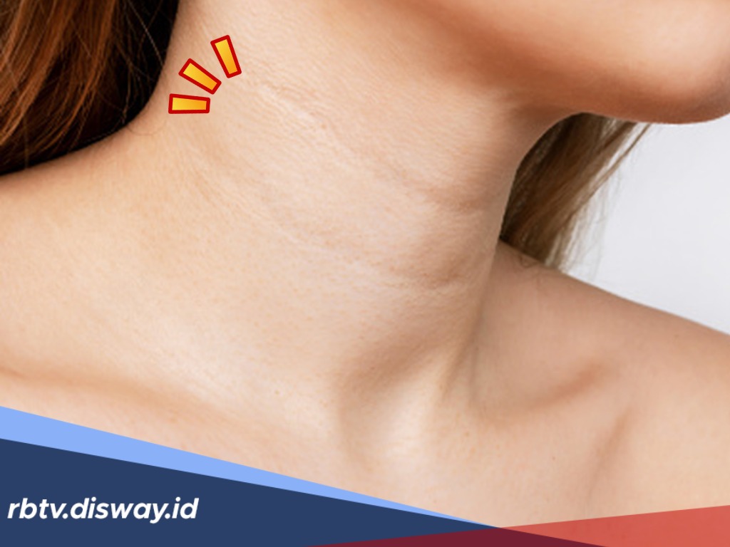 Makna di Balik Leher Bergaris Dua, Benarkah Pembawa Keberuntungan?