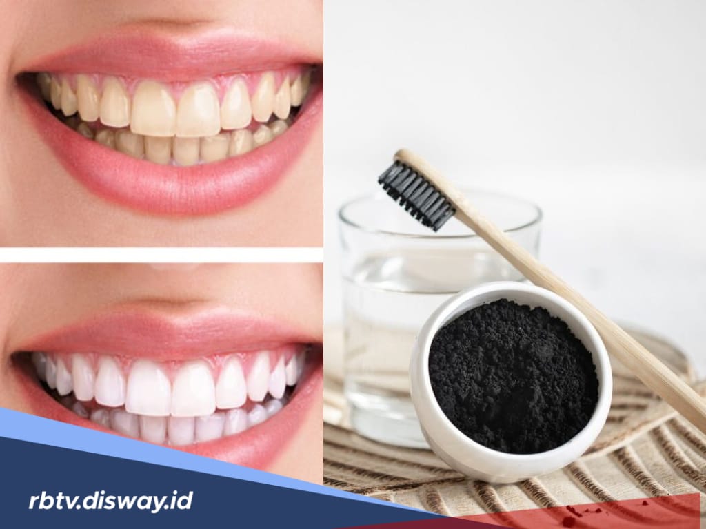 Tak Perlu Mahal, Begini Cara Memutihkan Gigi dengan Arang Batok Kelapa, Mudah dan Pasti Berhasil
