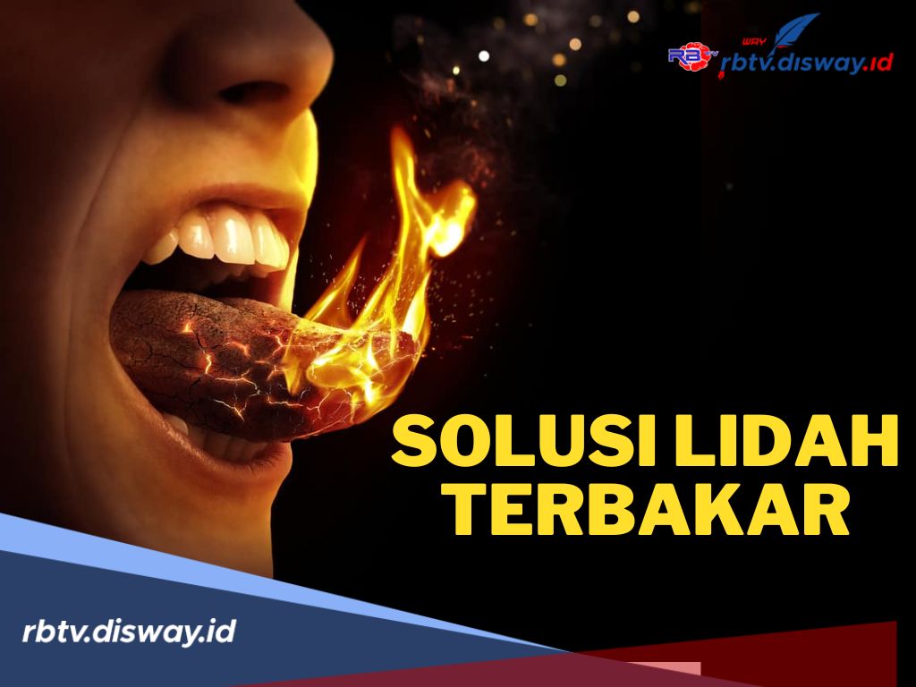  Solusi Tepat dan Cepat Mengatasi Lidah Terbakar, Pasti Sembuh!