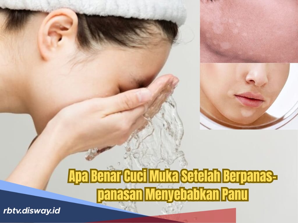Cuci Muka Habis Berpanas-panasan Bisa Sebabkan Panu, Ini Kata Dokter Tirta