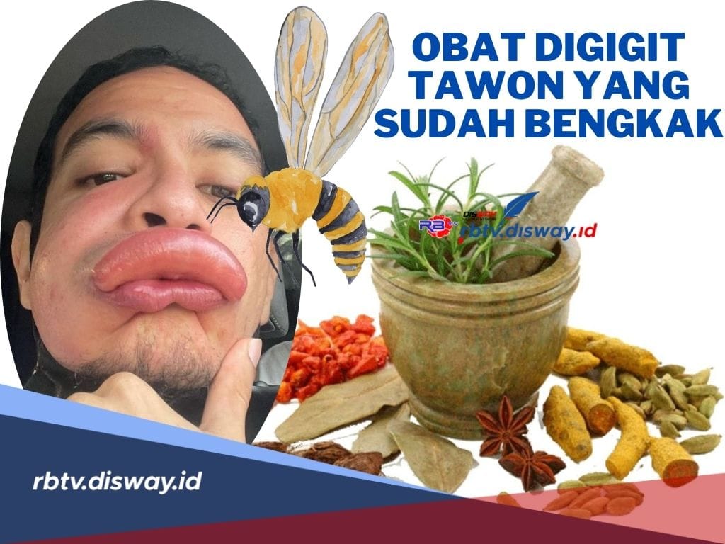 6 Rekomendasi Obat Disengat Tawon yang Sudah Bengkak, Bahannya Ada di Rumah