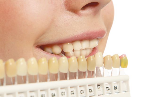 5 Cara Agar Gigi Selalu Putih dan Tidak Menguning, Salah Satunya Stop Merokok