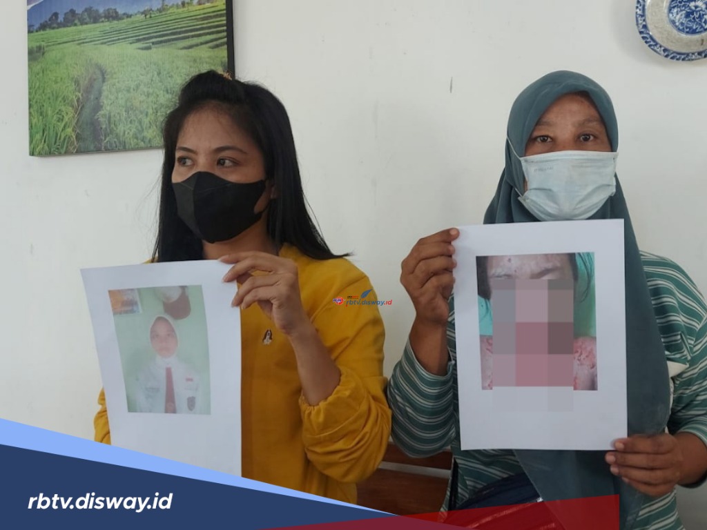 Seorang Remaja Diduga jadi Korban Malapraktik Oknum Bidan, Berawal dari Demam Hingga Berujung Buta