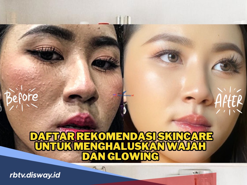 Punya Chicken Skin? Coba Yuk! Ini Daftar Rekomendasi Skincare untuk Menghaluskan Wajah dan Glowing