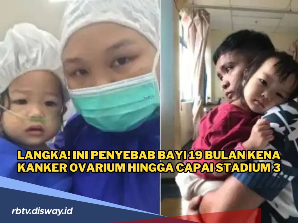 Langka! Ini Penyebab Bayi 19 Bulan Kena Kanker Ovarium hingga Stadium 3