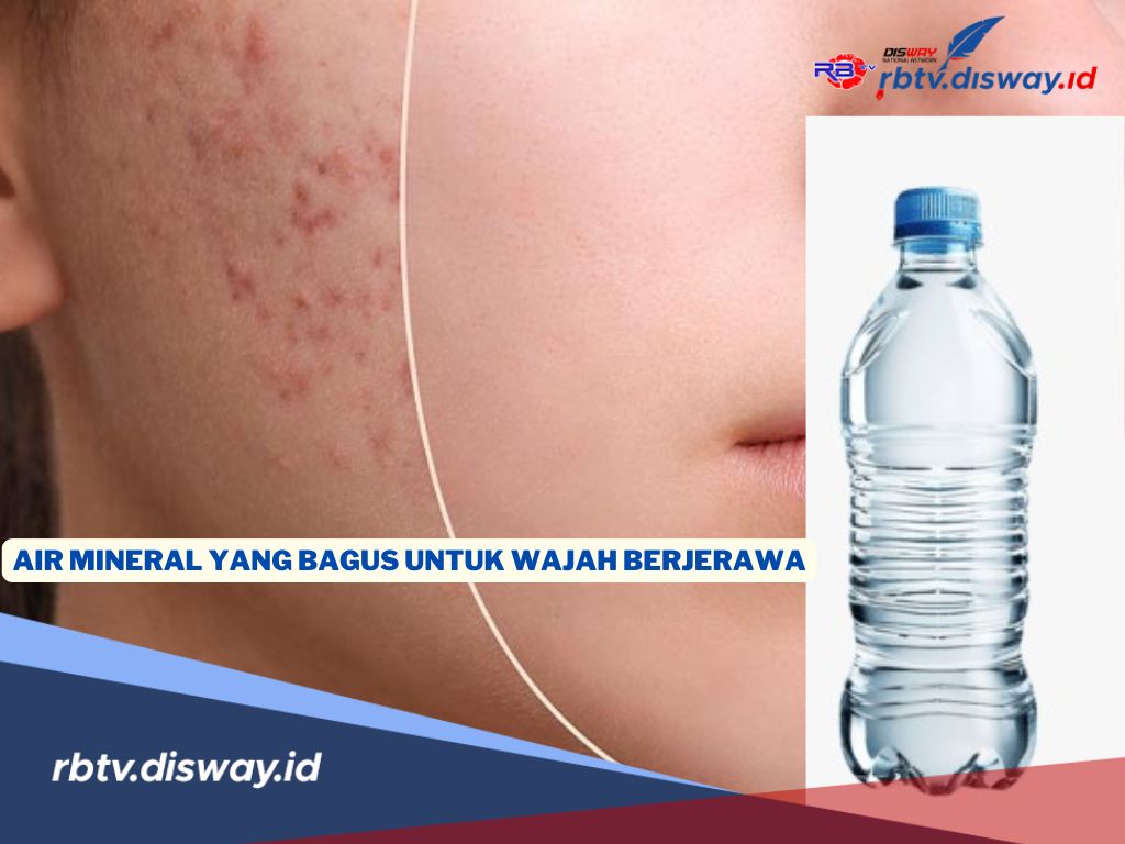  Air Mineral yang Bagus Bisa Bantu Atasi Jerawat, Rahasia Kulit Lebih Bersih