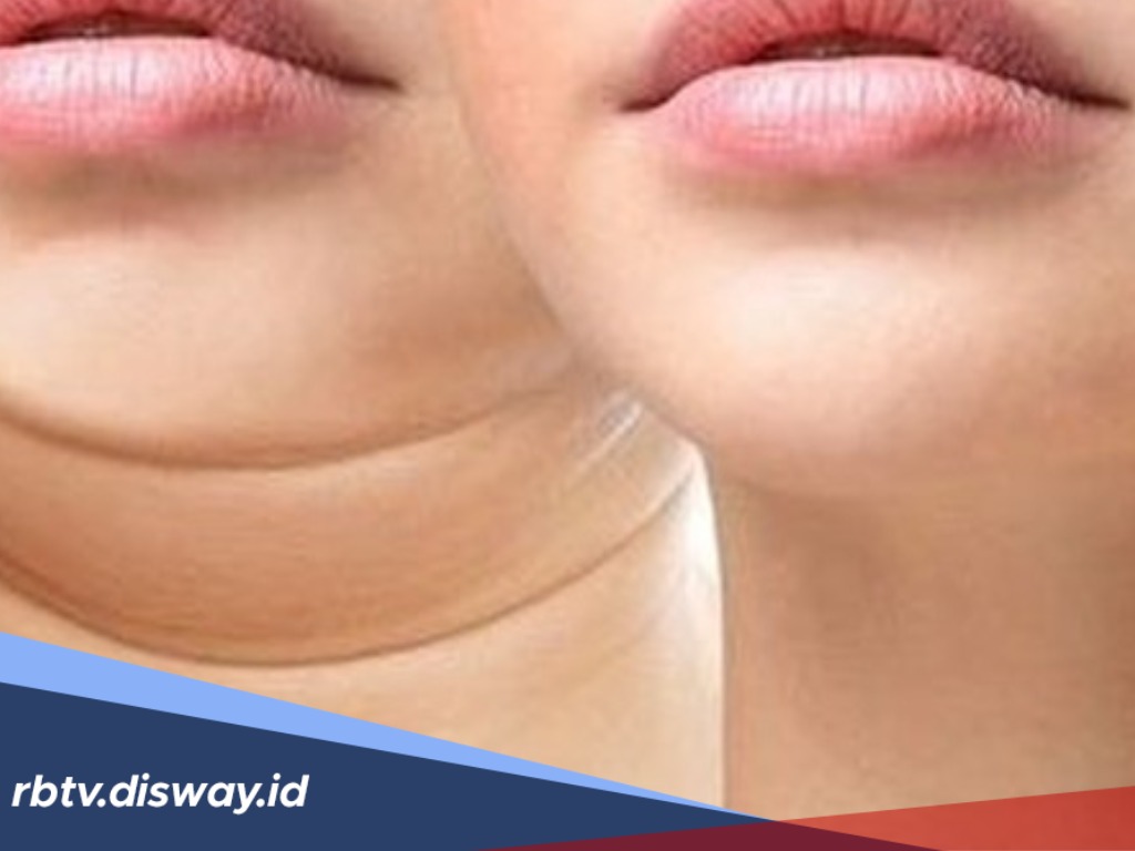 Garis di Leher Anda Memiliki Arti, Berikut Makna dari Leher Bergaris