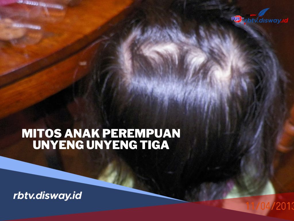 6 Mitos Anak Perempuan yang Memiliki Unyeng-Unyeng Tiga! Apakah Berbahaya?