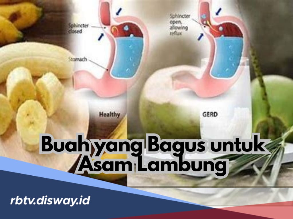 Ini 9 Buah yang Baik untuk Penderita Asam Lambung, Makan Tak Perlu Was-was